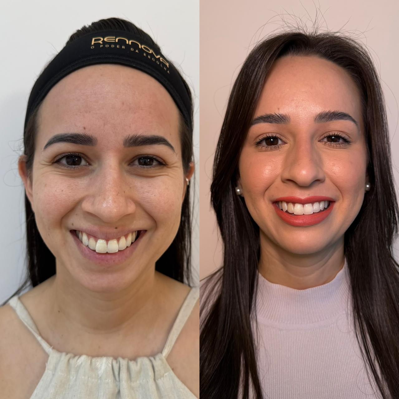 Antes e depois — resultado 8